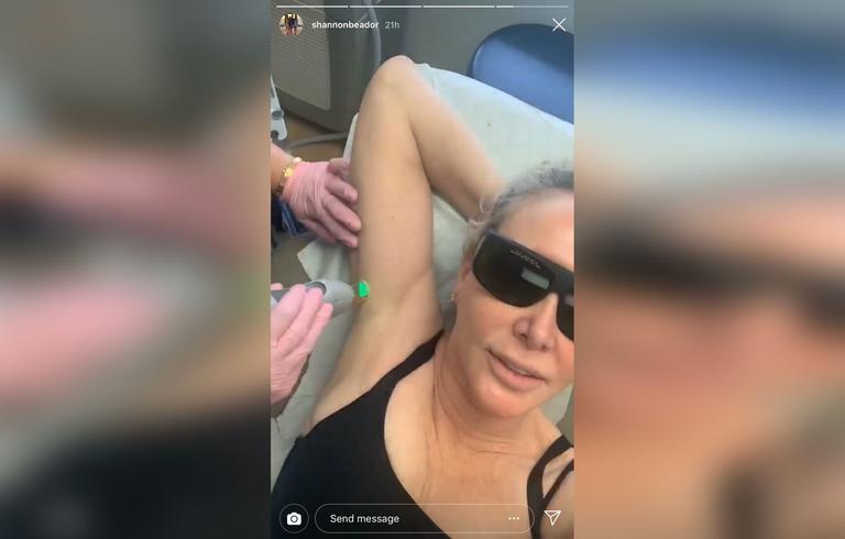 RHOC Star Shannon Beador Going Overboard With Plastic Surgery