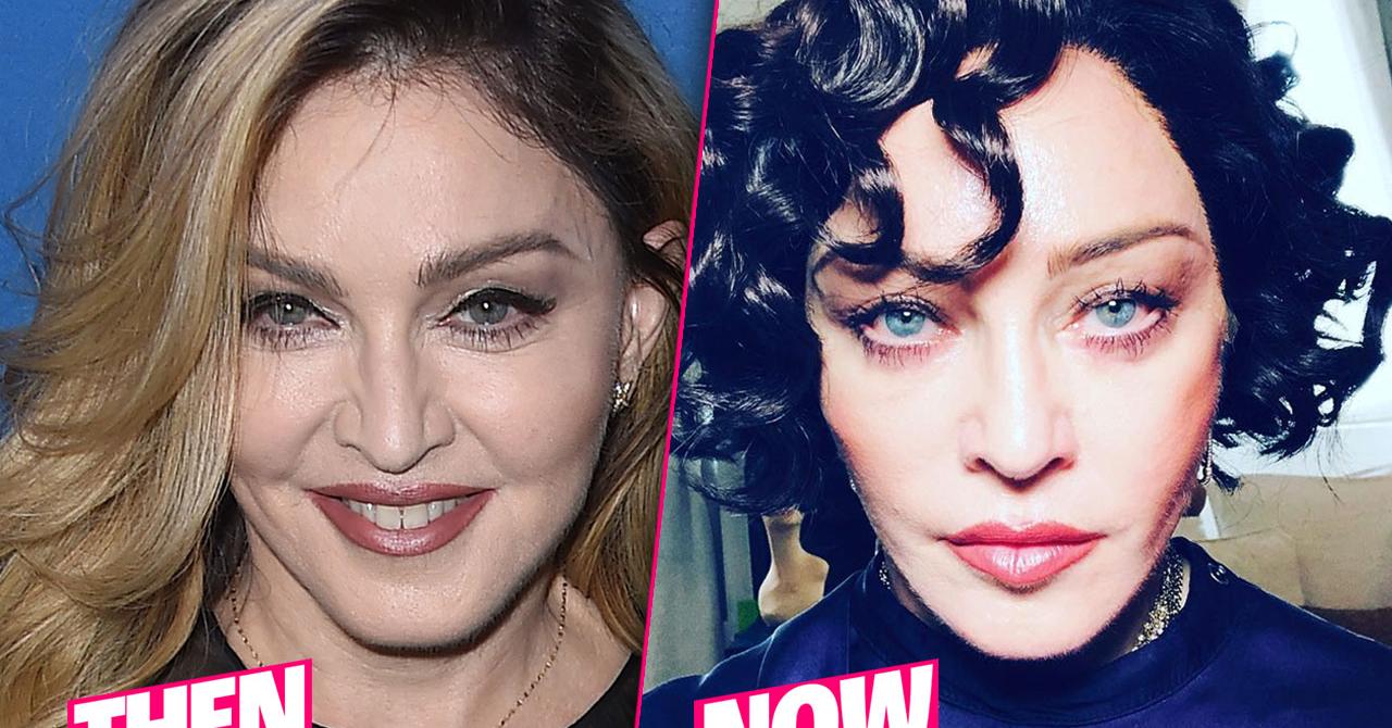 Madonnas Shocking Plastic Surgery Makeover Exposed By Top Docs 2158