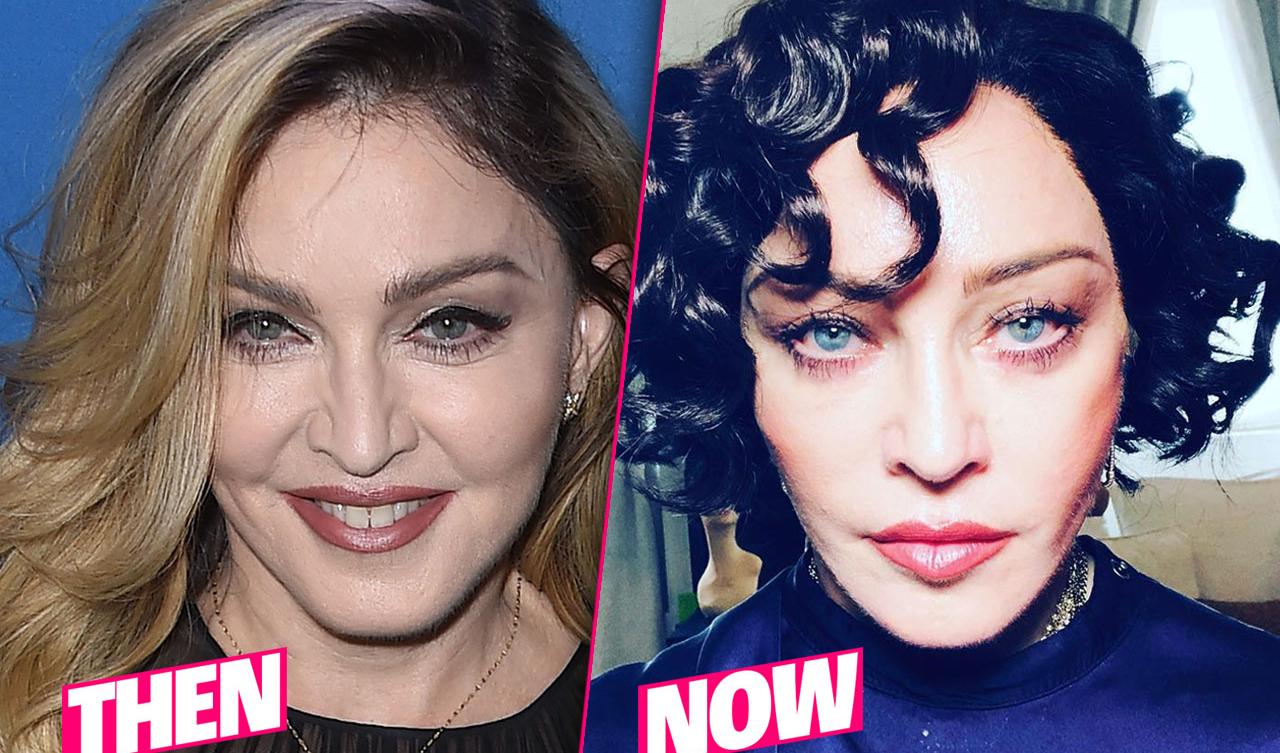 Madonnas Shocking Plastic Surgery Makeover Exposed By Top Docs