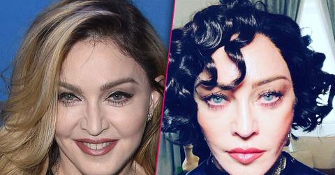 Madonna Before After Plastic Surgery