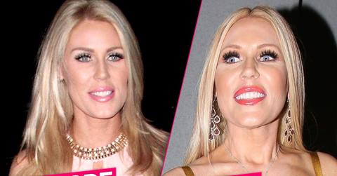 //Gretchen Rossi Plastic Surgery pp