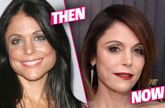 //bethenny frankel plastic surgery rumors botox doctor tells all pp