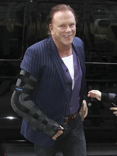Mickey Rourke Has A Broken Arm