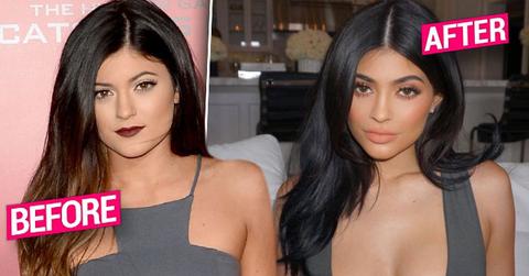 //kylie jenner plastic surgery boob job rumors pp