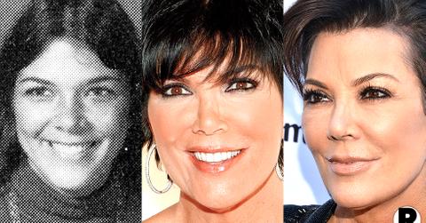 Kris Jenner Nose Melting Like Michael Jackson