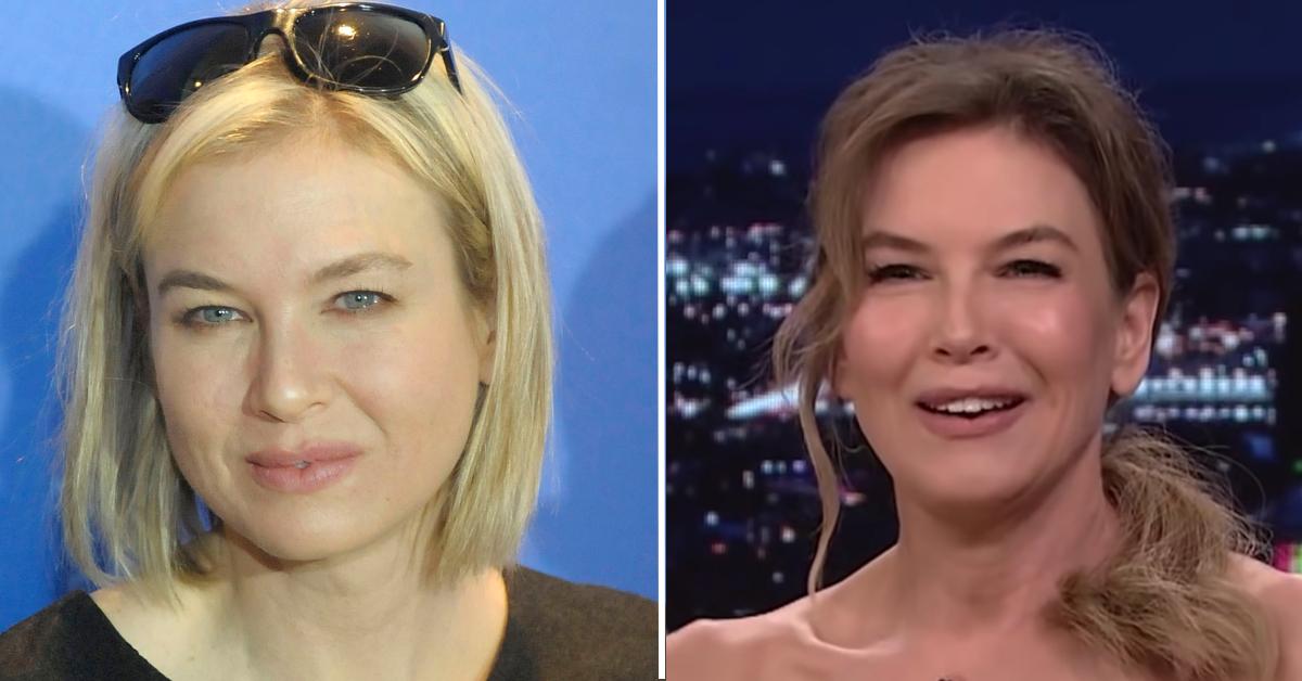 Renee Zellweger Debuts Tight Face Plastic Surgeons Weigh In