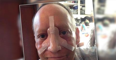 Steve Bean Levy Dead Nose Cancer Battle