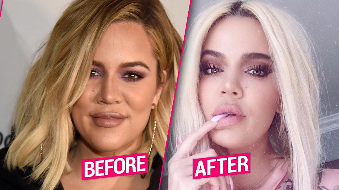 Khloe Kardashian’s Plastic Surgery Makeover After Split