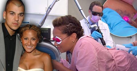 //adrienne bailon tatto removal