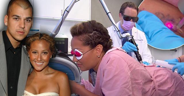 //adrienne bailon tatto removal