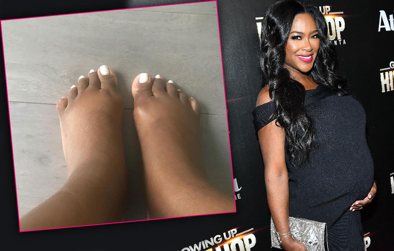 RHOA Kenya Moore Reveals Pregnancy Complication Preeclampsia