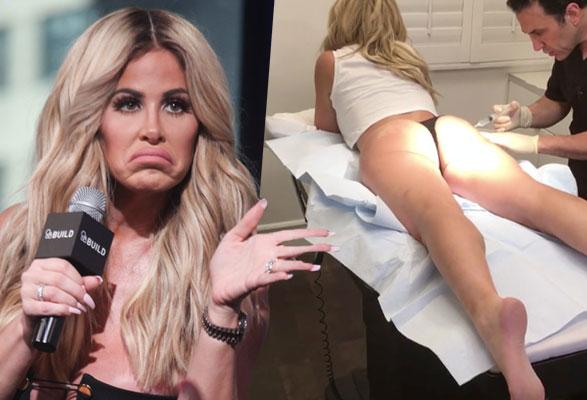 Kim Zolciak exposes her bottom in thong as she gets body contouring session