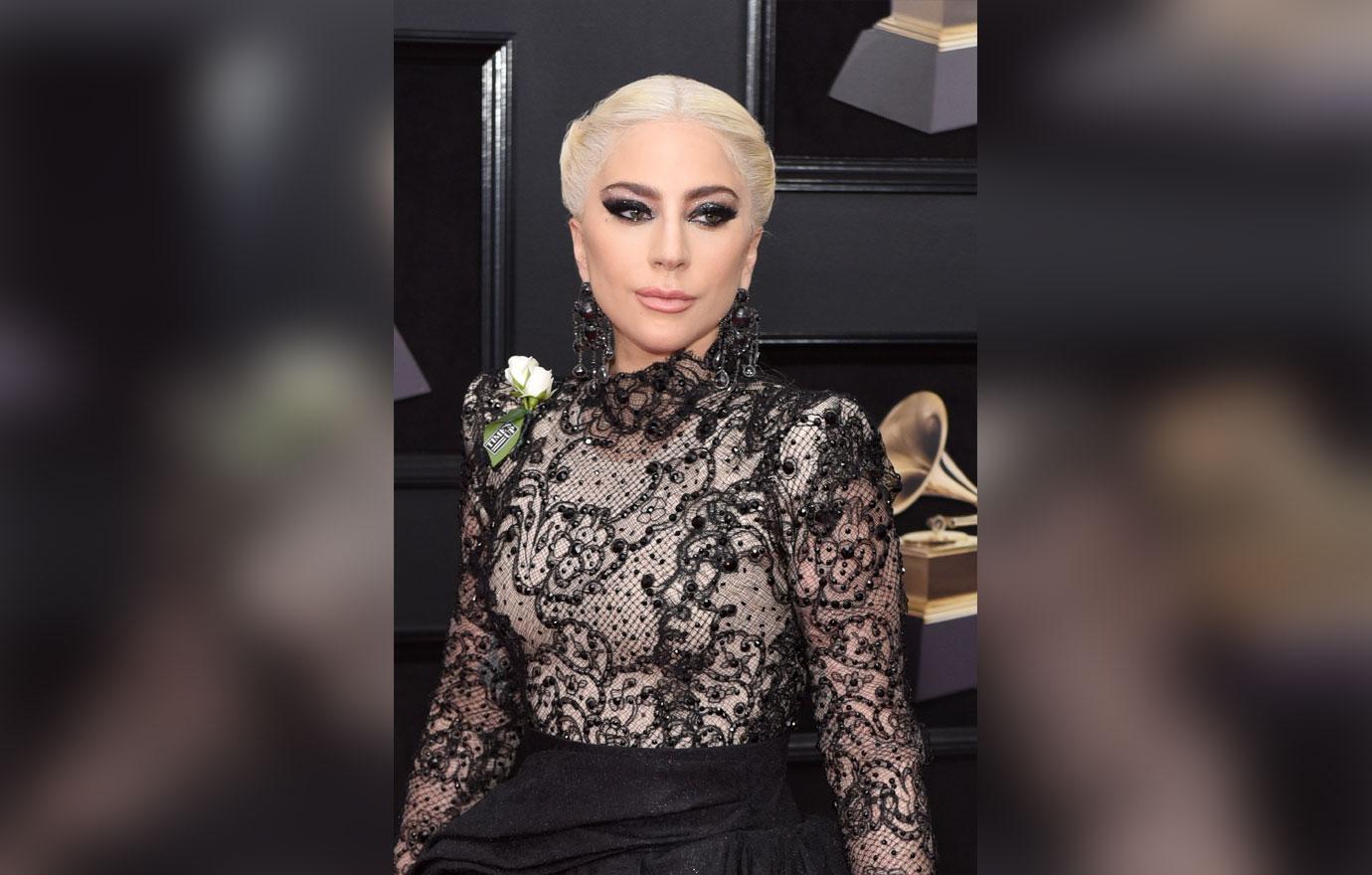 lady gaga plastic surgery Image 8