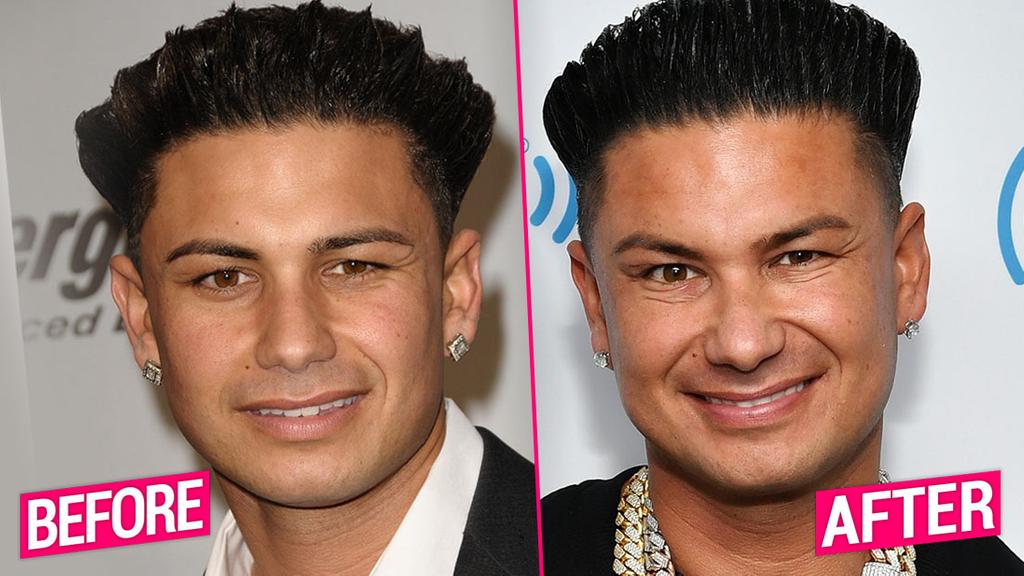 'Jersey Shore' Cast's Shocking Plastic Surgery Transformations Revealed