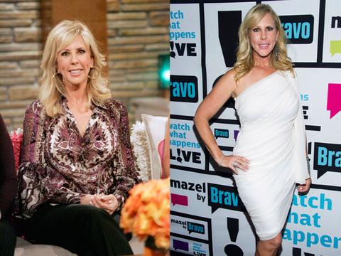 Real Housewives' Plastic Surgery Secrets REVEALED! 18 Stars Who've Gone