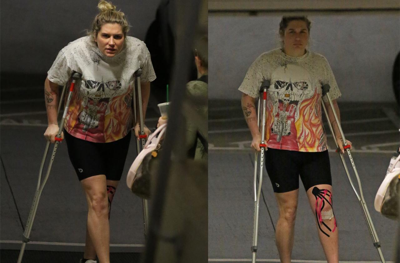 //kesha walks on crutches pp