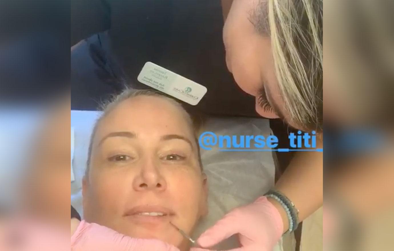 'RHOC' Star Shannon Beadors Multiple Plastic Surgery Procedures Since January Facelift Revealed