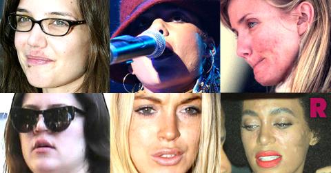 //celebrity skin problems pp