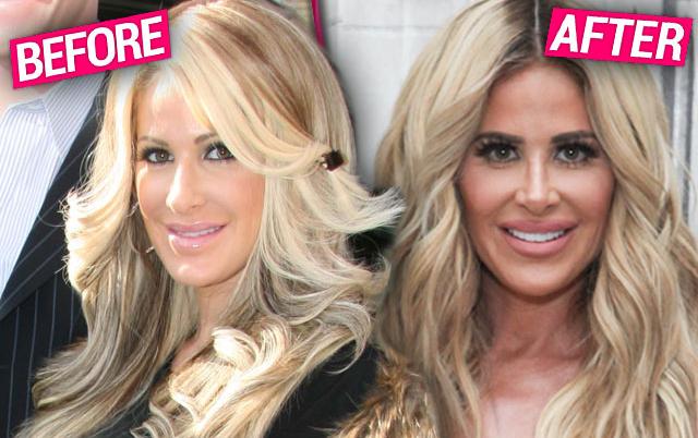 Kim Zolciak Biermann Plastic Surgery Claims Exposed By Top Docs   Kim Zolciak Biermann Plastic Surgery Exposed RHOA Pp 