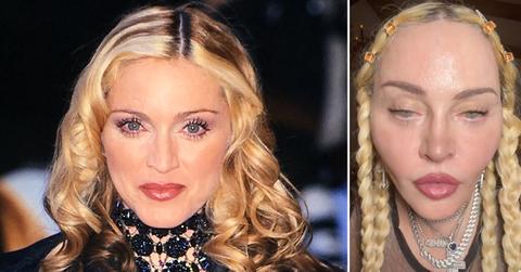 madonna face tiktok plastic surgery