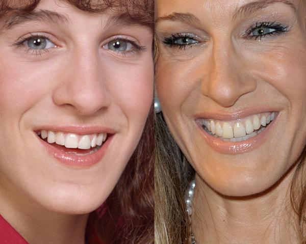 They May Be Beautiful But These Celebs Were Given A Bad Set Of Chompers