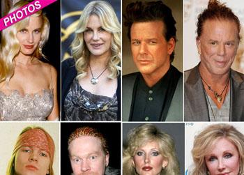 //sex symbols under the knife getty inf wenn bauergriffin