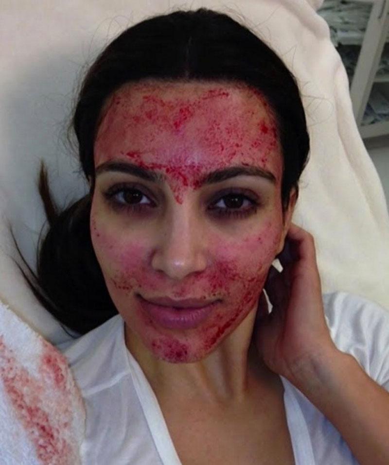 weird celebrity beauty treatments