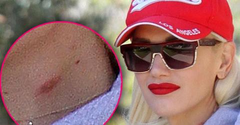 Blake Shelton Gwen Stefani Dating PDA Neck Hickey Pics