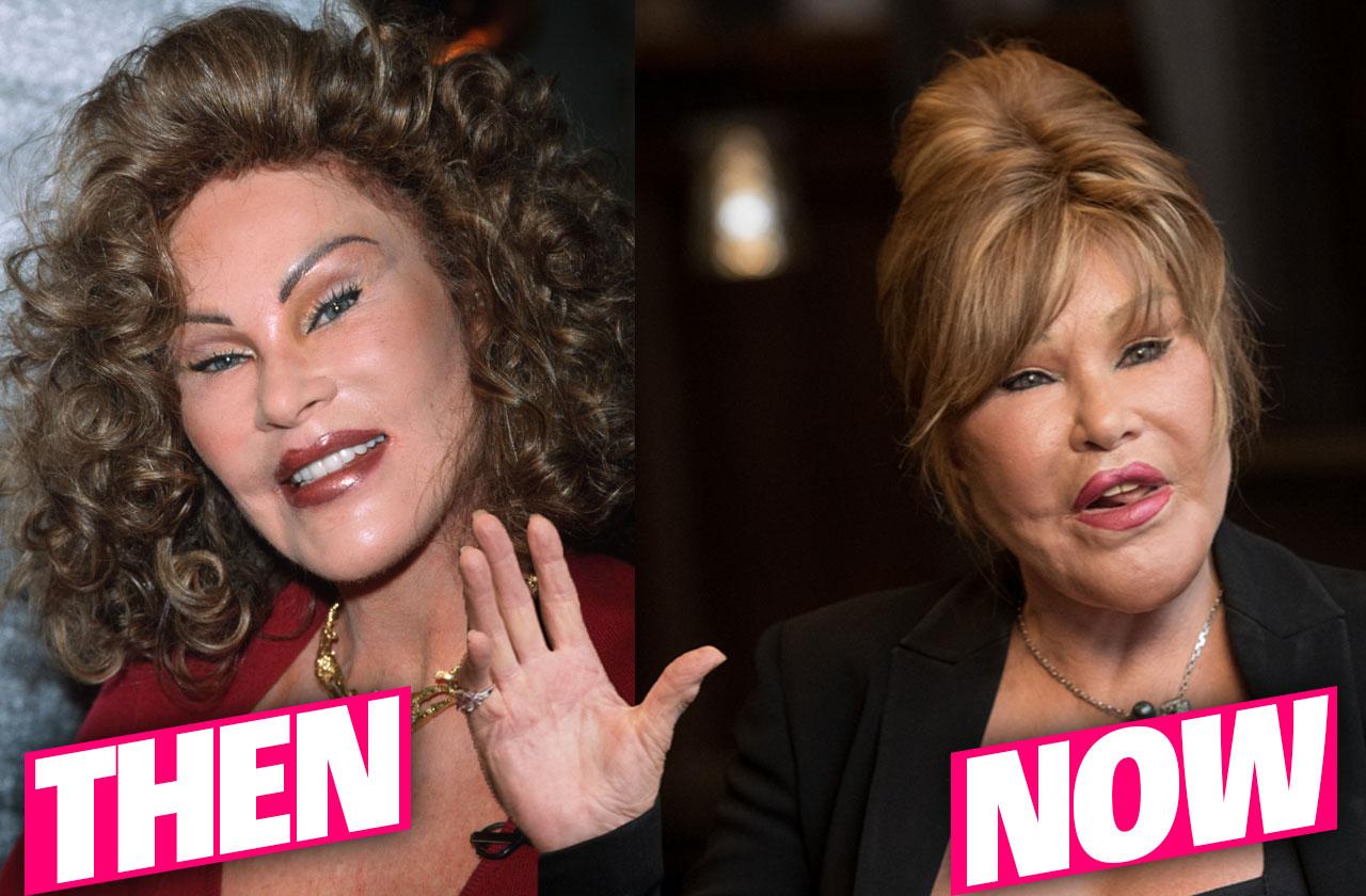 From Swiss Beauty to Plastic Surgery Disaster: Jocelyn Wildenstein