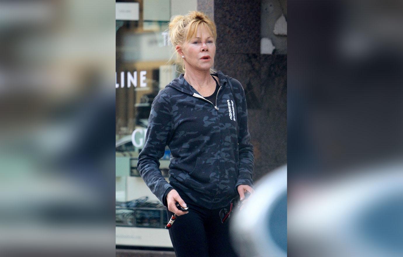 Melanie Griffith Wears Nose Bandage After Skin Cancer Treatment