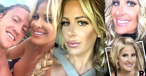 Kim Zolciak Face Lift