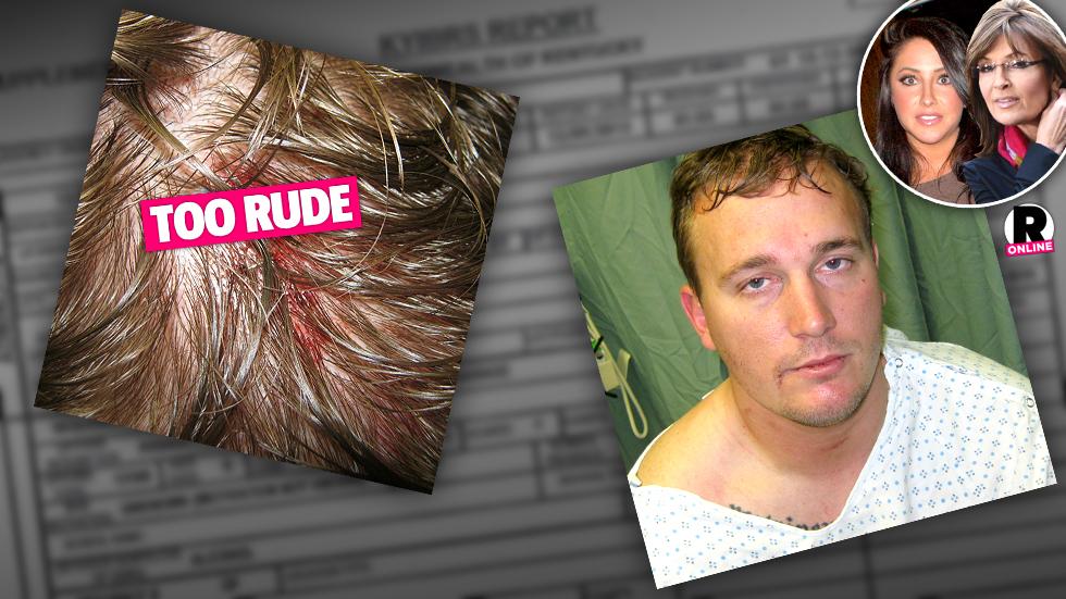 Bristol Palin Fiance Dakota Meyer Injured In Druken Party Fight Photos