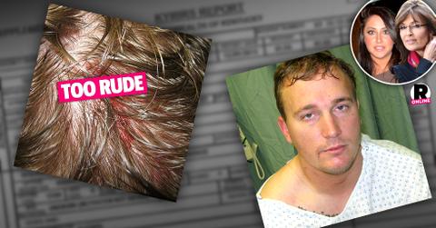 Bristol Palin Fiance Dakota Meyer Injured In Druken Party Fight Photos