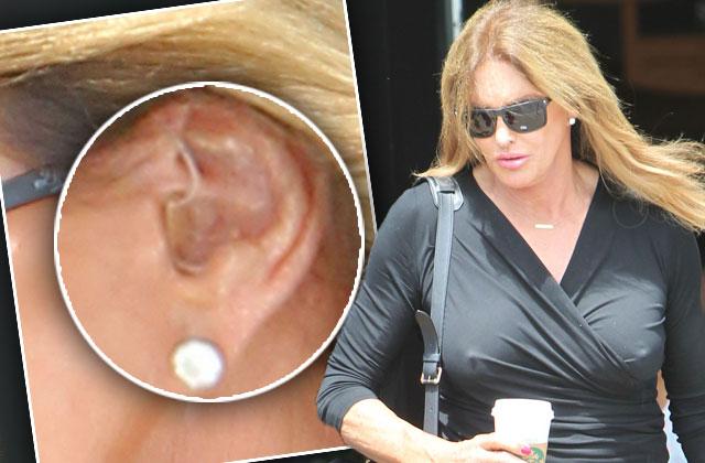 Caitlyn Jenner Hearing Aid Photos