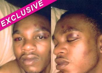 //perry alexander beaten gardena police