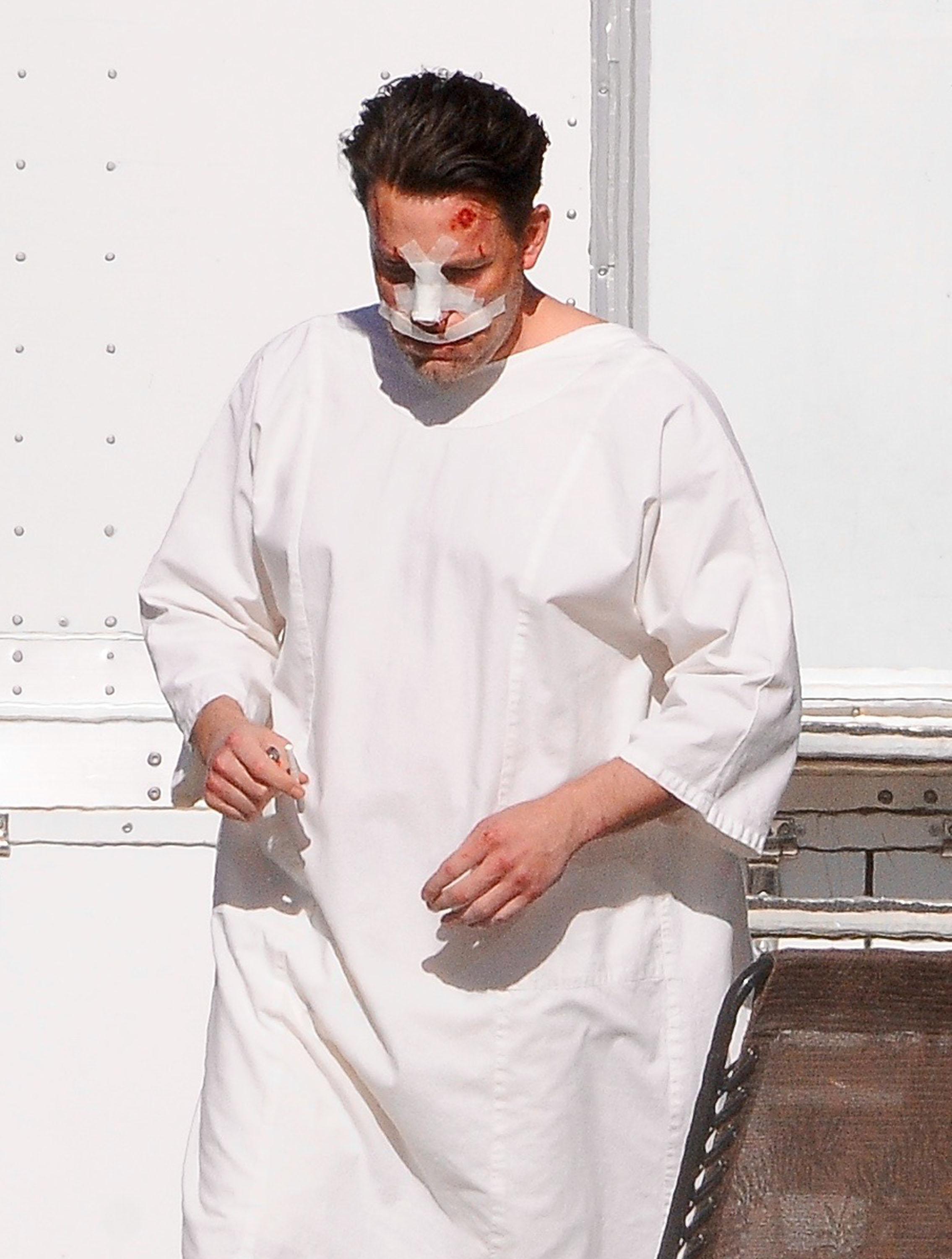 Ben Affleck Plastic Surgery Rumors Bloody On Set