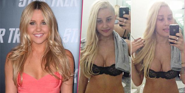 Amanda Bynes is suffering from the painful price of plastic surgery after h...