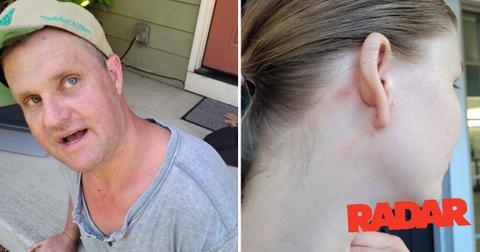 zachery ty bryan injurries pp