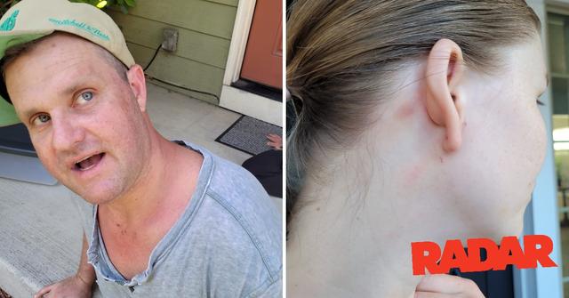 zachery ty bryan injurries pp