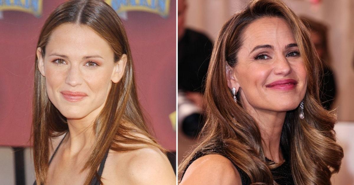 EXCLUSIVE: 'Medical-Grade Skincare' BUT No Plastic Surgery — How Jennifer Garner, 53, Has Maintained an 'Exceptional' Ageless Appearance