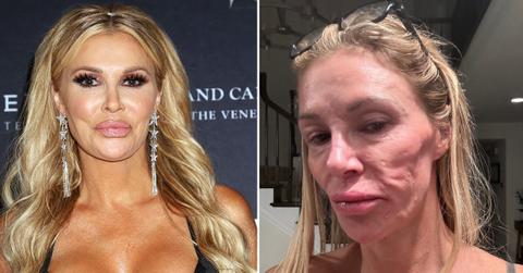 housewives brandi glanville parasite face appearance pp