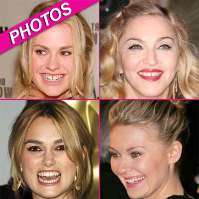 celebrities with no teeth