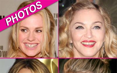 //celebs bad teeth wenngetty post
