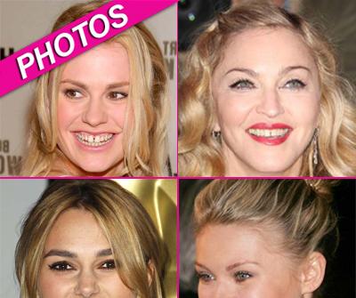 //celebs bad teeth wenngetty post