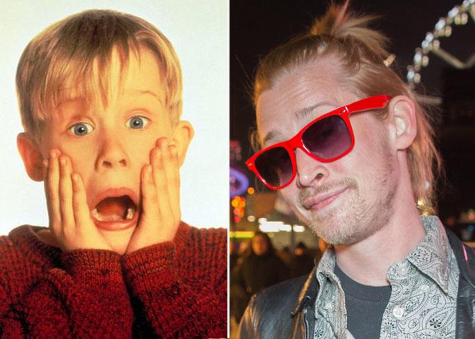 20 Dramatic Child Star Transformations! Who Has Gone Under The Knife ...