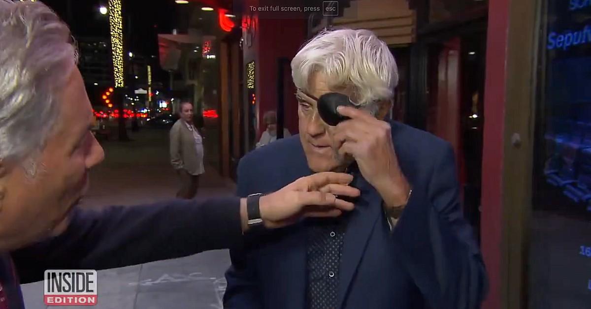 jay leno sports eye patch black and blue bruises after downhill fall