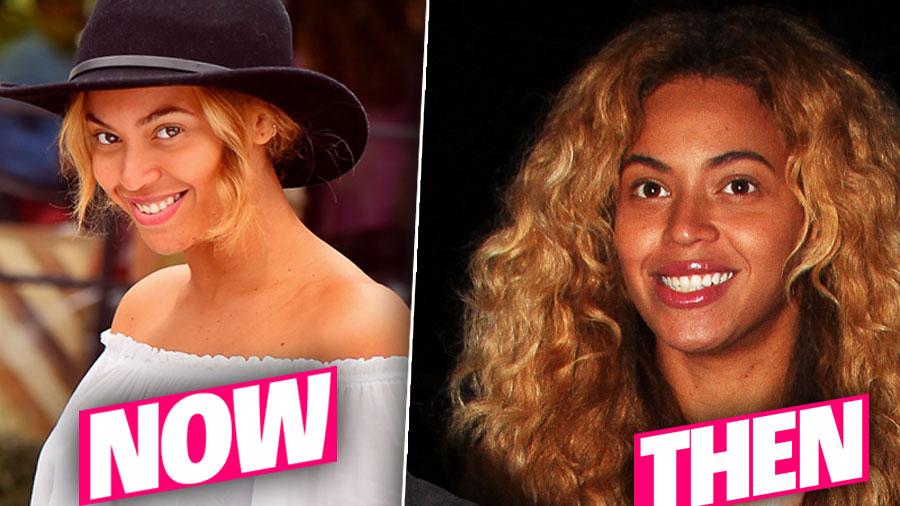 beyonce nose then and now