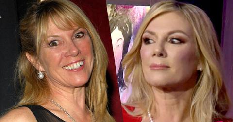 Ramona Singer Plastic Surgery RHONY