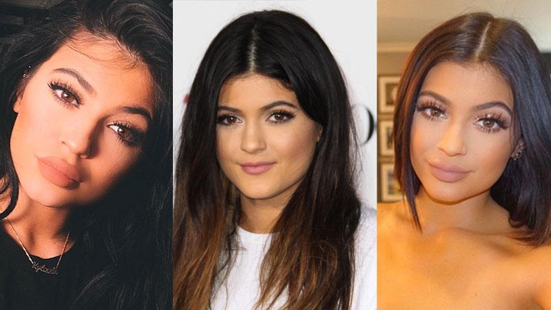 //kylie jenner lip enhancement surgery pp