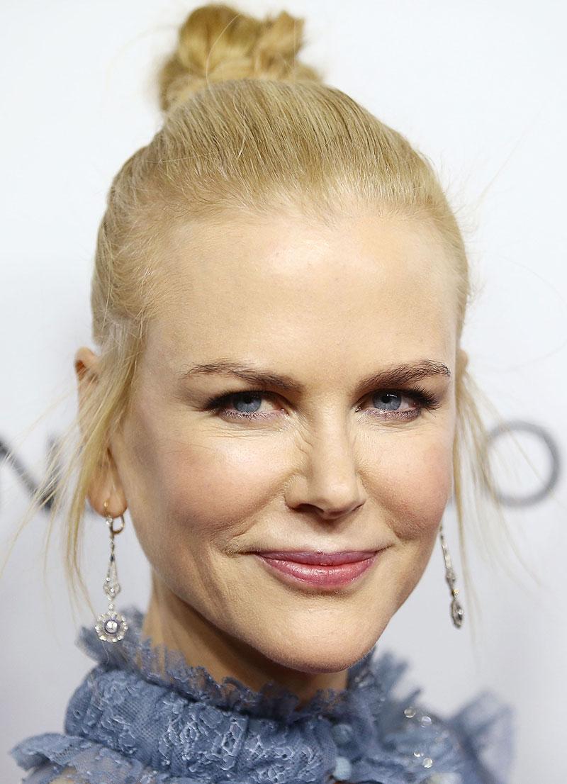 nicole kidman plastic surgeries